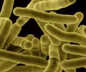 tuberculosis.jpg