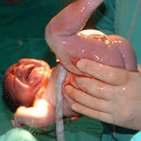 Imagen 0/3