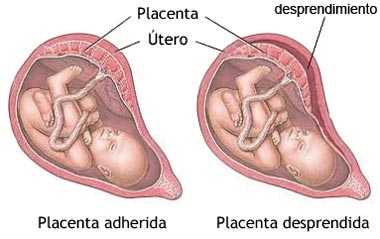 Imagen 0/1