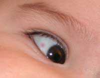 mancha-macular.jpg