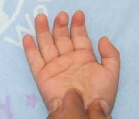 Imagen 0/1